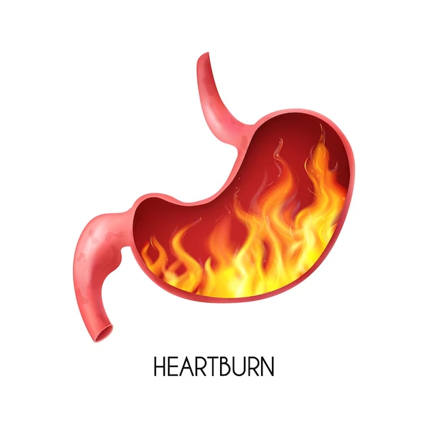 2025.-02.-19 - Heartbun stomach gastritis